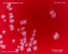 Yersinia pestis colonies